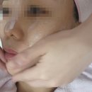 포항 문덕 피부관리 김지효피부연구소 슈퍼젝션 블랙 후기