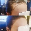 헤어보고 이미지
