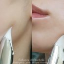 반하게스킨케어