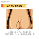 토브성형외과의원 이미지
