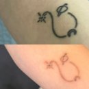 연세스타피부과의원 | 신촌 연세스타피부과 타투제거후기(4회차)+일주일 뒤