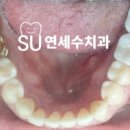 진치과기공소 이미지