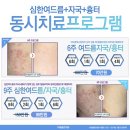 드아본 이미지