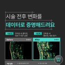 파라다이스의원 | 리프팅 효과가 없는 것 같다면? AI 메타스캔 피부 분석으로 확인해 보세요