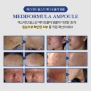 올메디 이미지