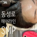 베이비왁서BW | 대구 헤어라인 SMP 잘하는곳 베이비왁서 -장미정원장