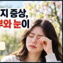 환절기 알러지 증상, 외출 후 피부와 눈이 가렵다면? 상황별 원인 분석 이미지