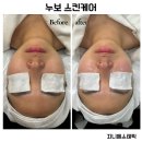 지니케어 이미지