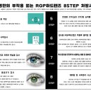 고안경 이미지