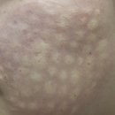 코코성형외과의원 | 내가 효과 본 좋은 시술 후기~