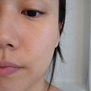 관골 | 움에스테틱 성성동 윤곽관리 예비신부 추천코스