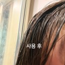 아이엠글로벌넷 샴푸 후기｜축 처지는 머리도 산뜻하게, 손상모 케어까지 찐후기♥️