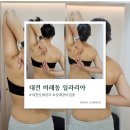 비래동로 | 대전 비래동 일라리아 상체집중관리 후기｜목·어깨 뭉침 근육 스트레칭 관리 받고 온 솔직후기