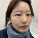 죽산시장 | [안성피부샵] 안성죽산 피부관리 맛집 하이드뷰티