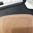 벨포인트의원 네이버블로그