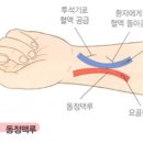 심낭골 | 성인간호학 내분비계 정리3