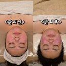 리브에스테틱 - 서구 | W.3 부산서면 예비신부관리잘하는곳 본리브에스테틱 솔직후기