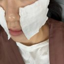 글래시피부과 | 글래시피부과 모공뿌시기 포텐자 + 미백프로그램 기미 잡티 제거 후기
