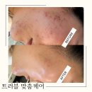 포미뷰티