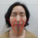 메디엘 이미지