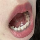 에이바아뜰리에 | 강남역 설측교정 내돈내산 후기 - 30대 교정 / 콤비교정(상악설측, 하악순측) / 악궁확장장치 등