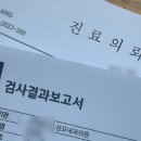 복강경 담낭(쓸개) 절제술 후기 : 서울성모병원