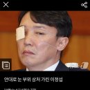 이정섭(탄핵검사) 눈은 왜그래요?ㅡ 이미지