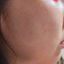 봄철&#39;문제성 피부 고민&#39; 리얼후기- 속효성이 뛰어난 샤르네 화장품으로 해결하세요^^