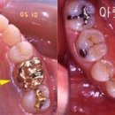 연 치과기공소 이미지