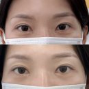 바나나 | 대전 속눈썹연장 잘하는 곳 바나나브로우 후기