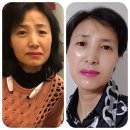 미인인셀덤