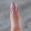 중앙의지보조기 이미지