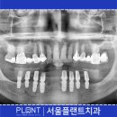 이플랜트치과의원 이미지