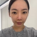 청담동피부과 통증없는 스킨부스터 NP리쥬란 리얼후기 2탄