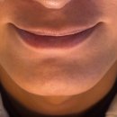 월촌고가차도앞 | [안산 고잔동 피부과] 드디어! 남자친구 수염 레이저 제모 진행한 후기 🧔🏻➡️👨🏻