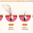 네오의원 이미지