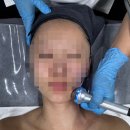 대구피부관리 에이원 뷰티그룹 플라즈마, 수분 LDM 후기