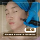 춘천피부관리 온의동 피부샵 예다움 스킨부스터 MTS 탄력관리 후기