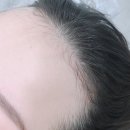 뷰티헤어라인 이미지