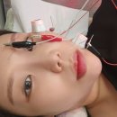 안면마비로 한의원만 여러곳 가본 후기 (일산지역 한정)