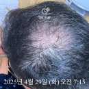 합덕터미널 | 당진 합덕 탈모병원 빠른 진료 꿀팁 공개 전국탈모인이라면 필독