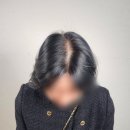 소생의원 | 울산두피문신 찐 후기 가르마 숱 보강하고 여름철 쳐진 볼륨 완벽 심폐소생함 !!