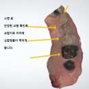 센트릭치과기공소 이미지