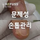 레푸스목포 | 찢어지고 박리되던 문제성 손톱 관리 전후차이 직접 비교해 보세요!