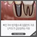 빠진 치아 방치할수록 여의도 임플란트 치료 난이도가 급상승하는 이유