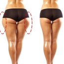 하체 | 승마살빼기 하체관리후기 목동 에스테틱 미인본가 가격