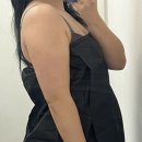 닥터봄춘의원 | 닥터손유나의원 팔뚝살 고민 | 매직팔뚝캣 1회차 내돈내산 솔직후기