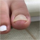 미엘네일닥터아이티엔범계지점 | 안양내성발톱 건강한 케어 해주는 미엘네일 닥터아이티엔 범계지점