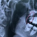 사직부부치과의원 이미지