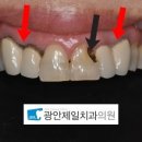 광안치과기공소 이미지